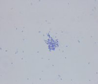 CSF Pseudomonas aeruginosa and Enterobacter cloacae
