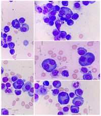 Binucleated plasma cells