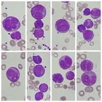 APL microgranular