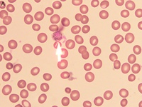Plasmodium vivax gametocyte 1