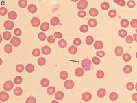 Plasmodium vivax gametocyte 2
