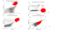 Flow Cytometry an Important Diagnostic Tool in Myelomatous Pleural Effusion 2