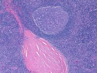 Image B