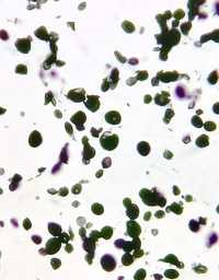 CRYPTOCOCCUS, Abdominal LN, GMS stain