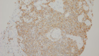 CD5 stain