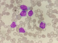 Blastoid cells