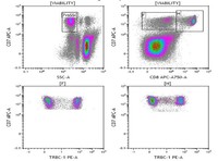 TRBC1 positive