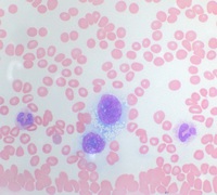 Peripheral Blood Smear (Wright-Giemsa 60X)