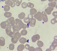 Plasmodium falciparum- male gametocyte