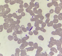 Plasmodium falciparum- female gametocyte