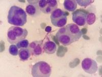 Multi nuclear Plasma Cells