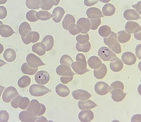 Developmental stages of Plasmodium vivax 1