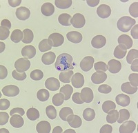 Developmental stages of Plasmodium vivax 2
