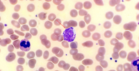 Basophil