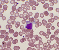 Large Granular Lymphocyte 2