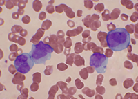 Promyelocyte