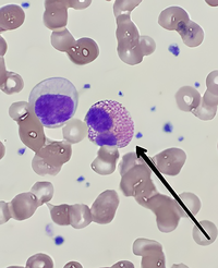 Eosinophil