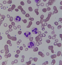 Neutrophil