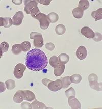 Eosinophilic Myelocyte